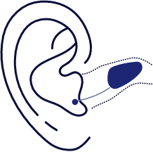 Invisible-In-the-Canal hearing aids illustration