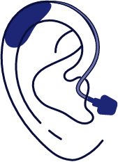 Open BTE hearing aid illustration